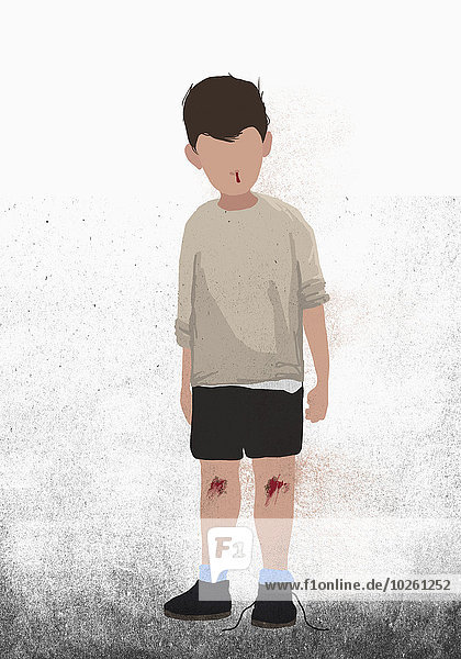Illustratives Bild des Jungen mit blutenden Knien und Nase über weißem Hintergrund