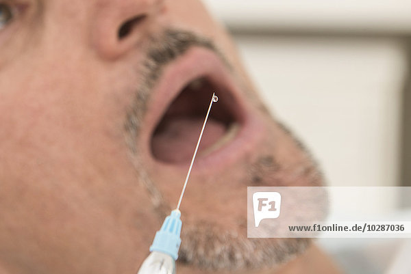 Syringe with hypodermic needle over patient's mouth  Munich  Bavaria  Germany