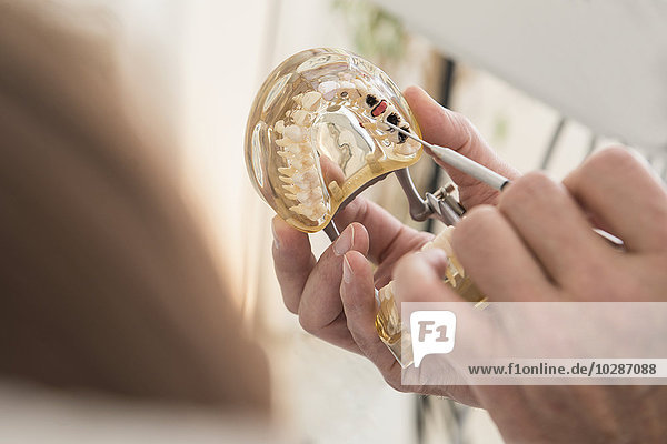 Zahnärztliche Hand zeigt ein Modell von Zähnen mit Karies  München  Bayern  Deutschland