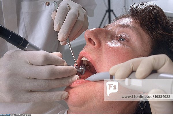Zahnarztpraxis  dem Patienten wird ein Zahn gezogen