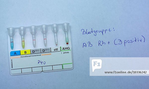 Blutgruppendefinition Labor Gesundheitswesen Und Medizin zum Beispiel Mutterschaftsvorsorge: Blutgruppe VON Rh+ (D positiv)