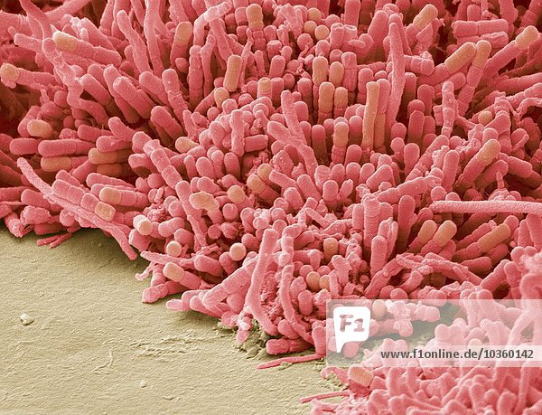 Plaque-bildende Bakterien  SEM