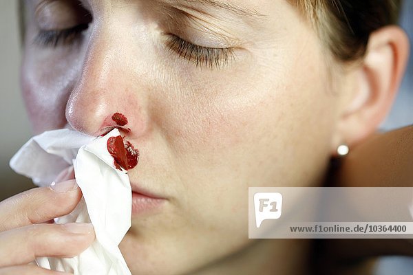 Junge erwachsene Frau hat Nasenbluten