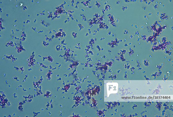 Lactobacillus acidophilus Bakterium  ein gram-positives Stäbchen. Phasenkontrast LM X160.