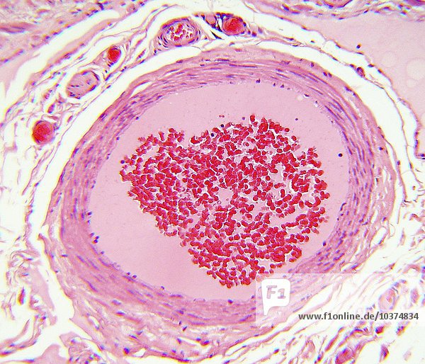 Menschliche Histologie - Arterie X160