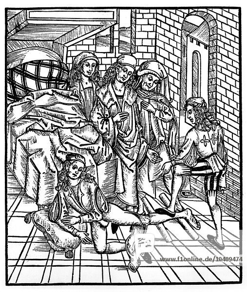 Brunschwig  Hieronymus (1450-c.1512) Surgeon directs as an assistant breaks and resets a leg  from Das Buch der Cirugia  published Strasbourg  1497 (litho) (b/w photo)