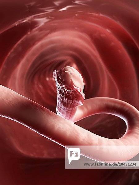 Roundworm in the intestines  computer artwork.