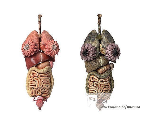 Gesunde und kranke weibliche Organe  Computerkunstwerk Gesunde und kranke Organe  Kunstwerk