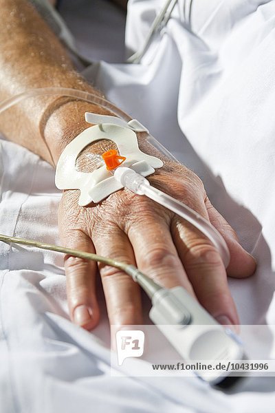 MODEL RELEASED. Intensive care patient's hand. Intensive care patient's hand