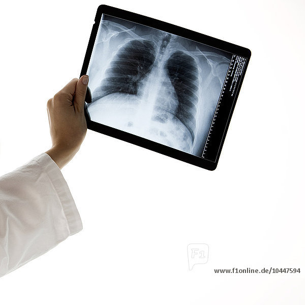 Hand eines Arztes mit Röntgenbild