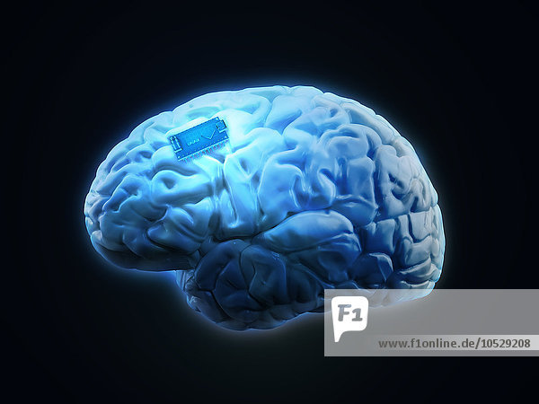 Menschliches Gehirn mit Mikrochip  Illustration