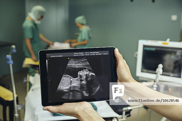 Hände halten eine digitale Tablette  die ein Ultraschallbild eines Fötus im Operationssaal zeigt.