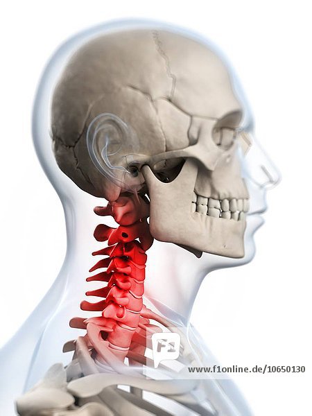 Human neck pain  artwork