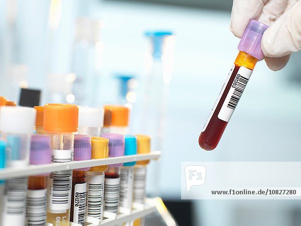 Labortechniker bei der Vorbereitung der Blutprobe für die medizinische Untersuchung im Labor