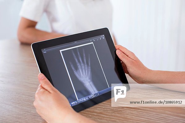 Frau hält digitales Tablett mit Röntgenbild der Hand auf dem Bildschirm