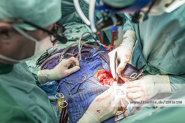 Chirurgen  die eine Herz-Bypass-Operation durchführen