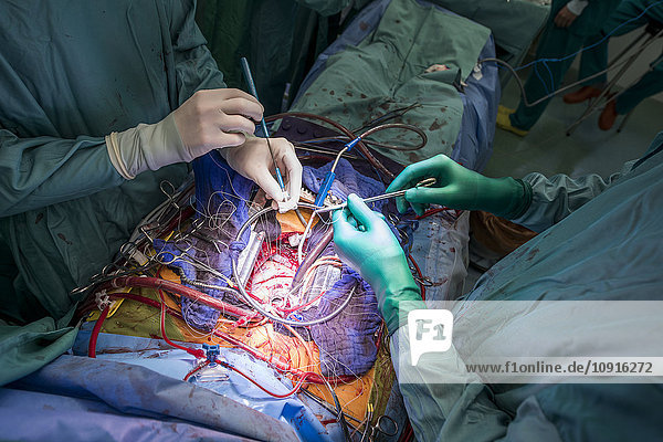 Herzchirurgen bei einer Herzklappenoperation
