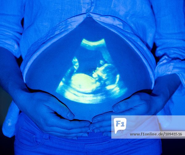 Schwangere Frau mit Baby-Scan auf dem Bauch