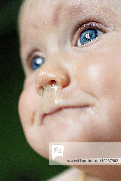 Ein Kind mit einer laufenden Nase  Schweden.