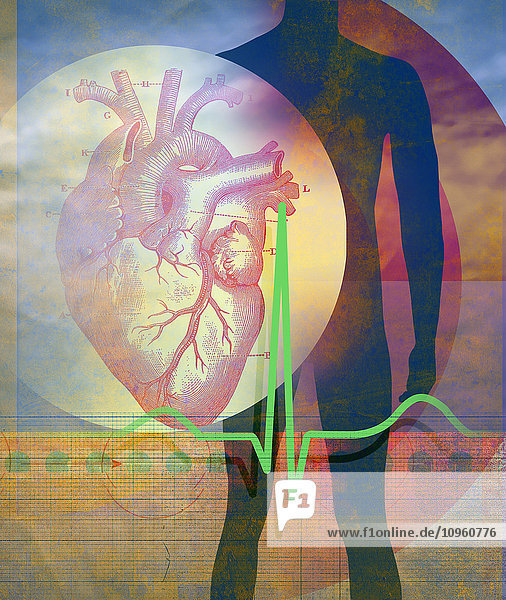 EKG  Zielscheibe und anatomische Illustration eines Herzens über dem Körper eines Mannes