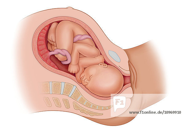 Cross section of the mothe'rs anatomy at 9 months showing the baby in uteruo LOA ready to be delivered