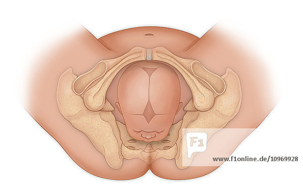 Doctor's view of a baby in occipital anterior position ready for delivery