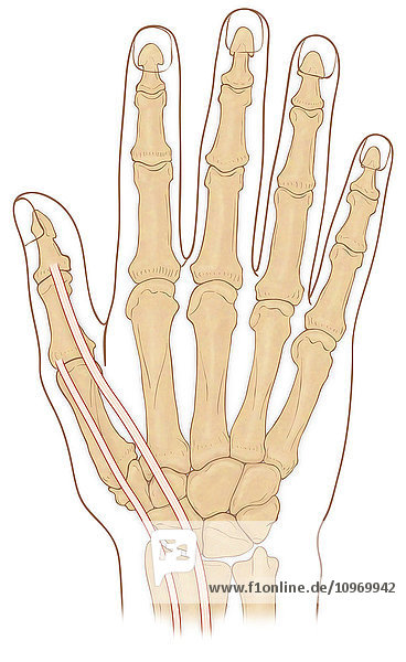 Normal anterior view of hand showing the anatomical snuff box