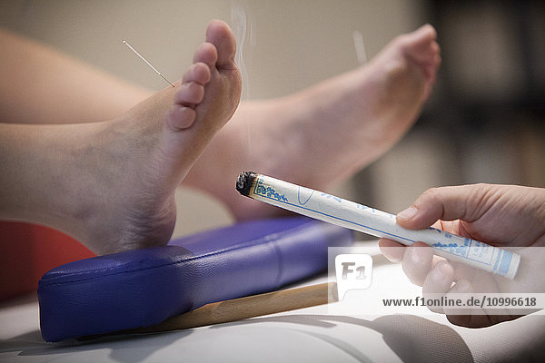 Reportage on a therapist who specialises in traditional Chinese medicine. The therapist combines the benefits of the needles with moxibustion. Stimulating this point under the foot allows a very relaxed state to be attained.