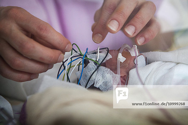 Reportage in einer mobilen Funktionsuntersuchungseinheit. Eine Krankenschwester führt in einer Neugeborenenstation bei einigen Frühgeborenen ein EEG-Check-up durch. Mit dem EEG kann die Entwicklung des Gehirns überwacht werden. Ein extremes Frühgeborenes  das mit 25 Wochen Amenorrhoe geboren wurde.