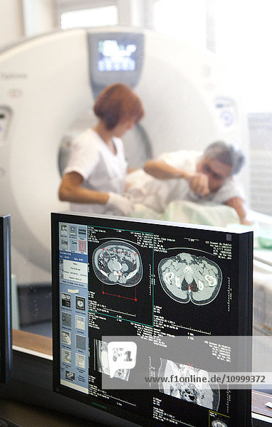 Reportage über einen radiologischen Dienst in einem Krankenhaus in Haute-Savoie  Frankreich. Scanner.