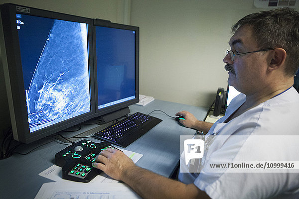 Reportage in einem radiologischen Dienst in einem Krankenhaus in Haute-Savoie  Frankreich. Ein Arzt interpretiert ein verdächtiges Mammogramm.