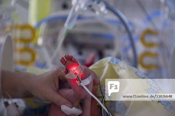 Frühgeborenes auf Intensivstation im Krankenhaus