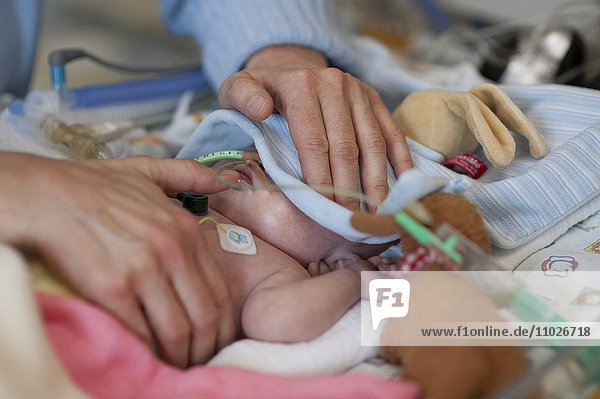 Frühgeborenes auf der Intensivstation eines Kinderkrankenhauses