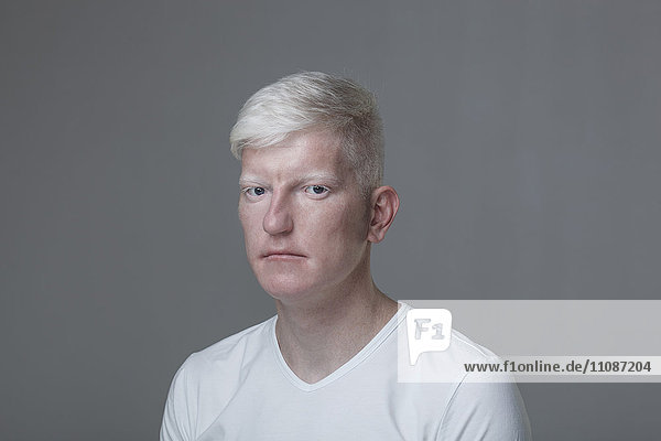 Portrait of albino man against gray background