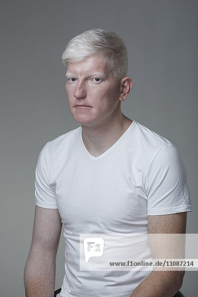 Portrait of young albino man sitting against gray background
