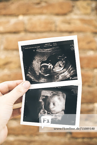 Frauenhände mit zwei Baby-Mädchen-Ultraschall  4D-Ultraschall