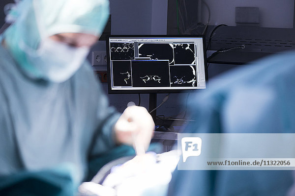 Neurochirurg während einer Operation und Monitor mit CT-Scans