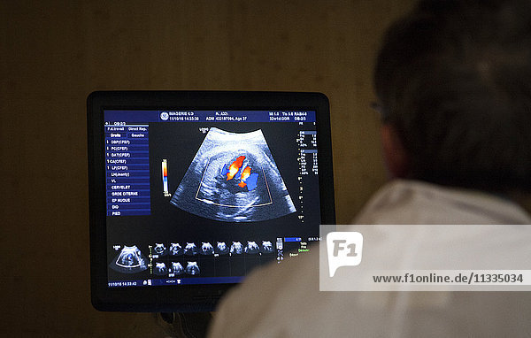 Reportage in einem radiologischen Zentrum in Haute-Savoie  Frankreich. Ein Radiologe führt eine Untersuchung im dritten Trimester durch. Der Blutfluss ist sichtbar.