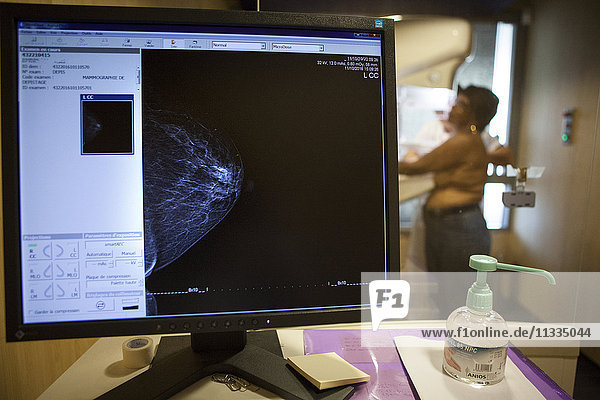 Reportage in einem radiologischen Zentrum in Haute-Savoie  Frankreich. Mammographie.