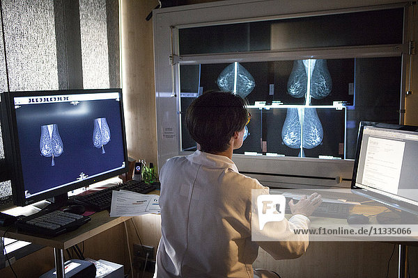 Reportage in einem Radiologiezentrum in Haute-Savoie  Frankreich. Ein Radiologe sieht sich die Ergebnisse von Mammographien an.
