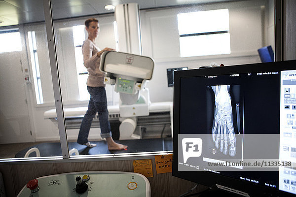 Reportage in einem Radiologiezentrum in Haute-Savoie  Frankreich. Ein Techniker röntgt den Fuß eines Patienten  der wegen eines Hallux valgus operiert wurde.