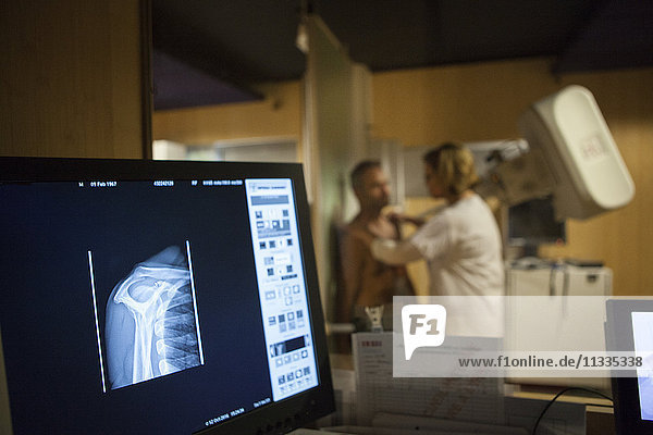 Reportage in einem Radiologiezentrum in Haute-Savoie  Frankreich. Ein Techniker positioniert einen Patienten für eine Röntgenaufnahme der Schulter.