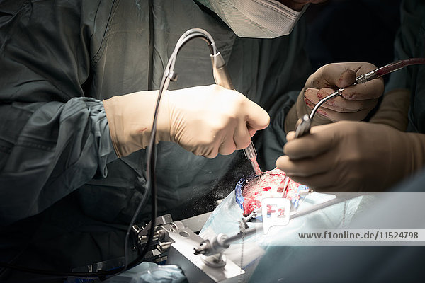 Neurochirurgen beim Öffnen des Schädels während einer Operation