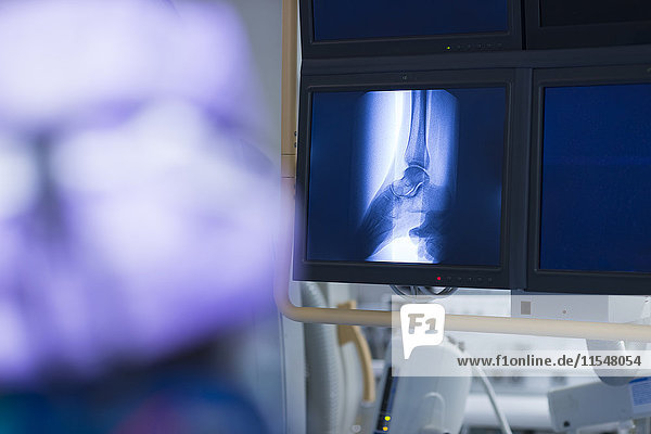 Radiologe beim Betrachten des Röntgenbildes