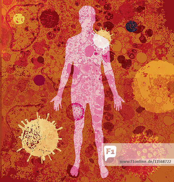 Menschlicher Körper mit vielen verschiedenen Viren
