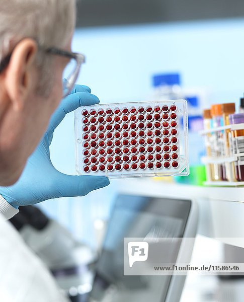MODELL FREIGEGEBEN. Wissenschaftlerin bei der Überprüfung einer Multiwellplatte mit Blutproben für Tests und Analysen im Labor