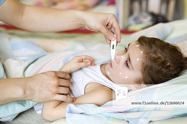 Girl having chickenpox lying in bed with clinical thermometer