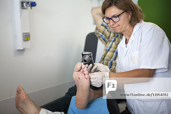 Reportage über die Fußsprechstunde für Diabetiker in einem Krankenhaus in Savoyen  Frankreich. Diese Beratungen werden von einem spezialisierten Team durchgeführt und sind der Behandlung und Nachsorge von Fußverletzungen bei Diabetikern gewidmet. Der Fußpfleger fotografiert die Wunde  um ihren Verlauf zu verfolgen.