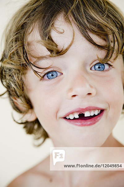 Boy With Missing Tooth
