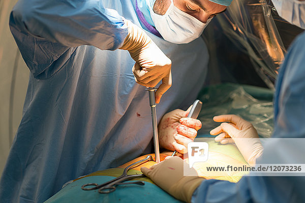 Reportage aus dem Operationssaal der orthopädischen Chirurgie im Krankenhaus Pasteur 2  Nizza  Frankreich. Markraumfreilegung und Arthrodese bei einem Patienten mit arthrosebedingter Lendenwirbelkanalstenose. Die Operation besteht darin  den Wirbelkanal von knöchernen Elementen zu befreien  die ihn zusammendrücken  und die Wirbelsäule mit einer Arthrodese zu verankern. Diese Operation wird mit dem O-Arm-System mit 3D-Bildern vor der Operation durchgeführt.